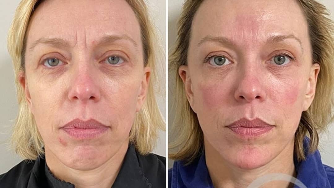 Crème Anti-Rides & Jeunesse à l'Astaxanthine – Hydratation Profonde & Effet Repulpant
