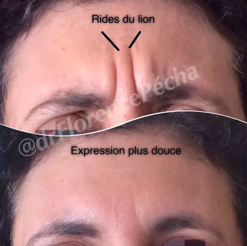 Crème Anti-Rides & Jeunesse à l'Astaxanthine – Hydratation Profonde & Effet Repulpant