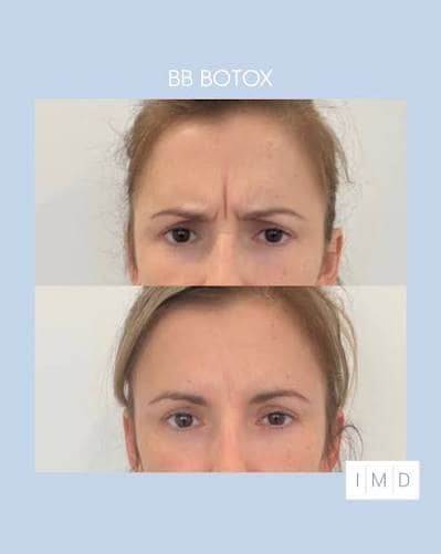 Crème Anti-Rides & Jeunesse à l'Astaxanthine – Hydratation Profonde & Effet Repulpant