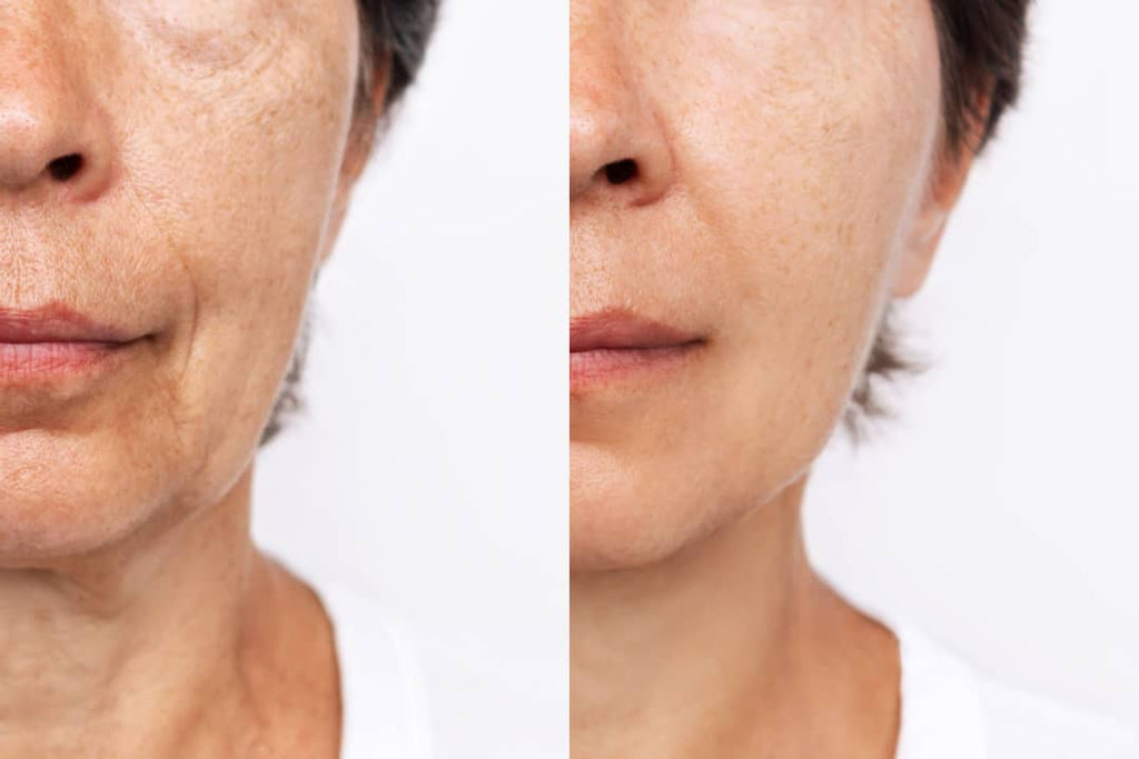 Crème Anti-Rides & Jeunesse à l'Astaxanthine – Hydratation Profonde & Effet Repulpant
