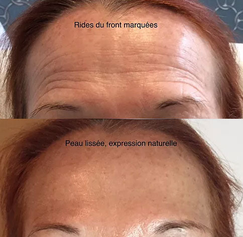 Crème Anti-Rides & Jeunesse à l'Astaxanthine – Hydratation Profonde & Effet Repulpant