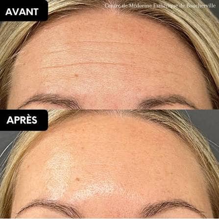 Crème Anti-Rides & Jeunesse à l'Astaxanthine – Hydratation Profonde & Effet Repulpant