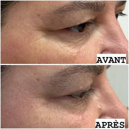 Crème Anti-Rides & Jeunesse à l'Astaxanthine – Hydratation Profonde & Effet Repulpant