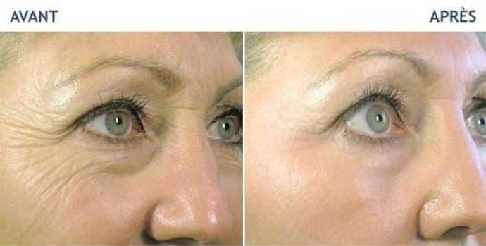 Crème Anti-Rides & Jeunesse à l'Astaxanthine – Hydratation Profonde & Effet Repulpant