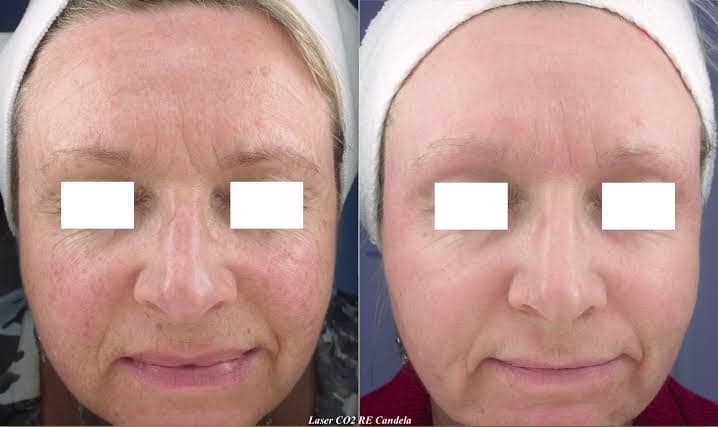 Crème Anti-Rides & Jeunesse à l'Astaxanthine – Hydratation Profonde & Effet Repulpant