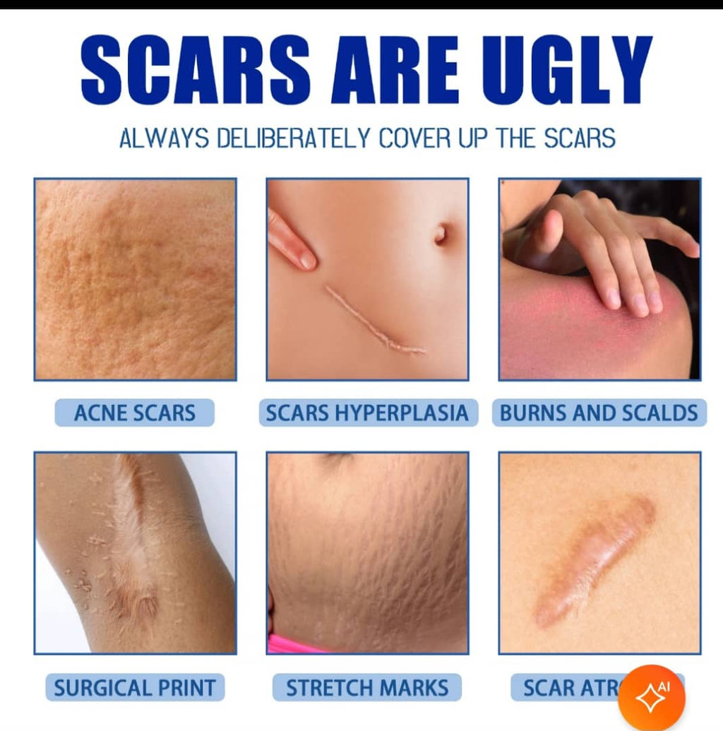 Crème Anti-Cicatrices & Vergetures SCAR – Réparation & Atténuation